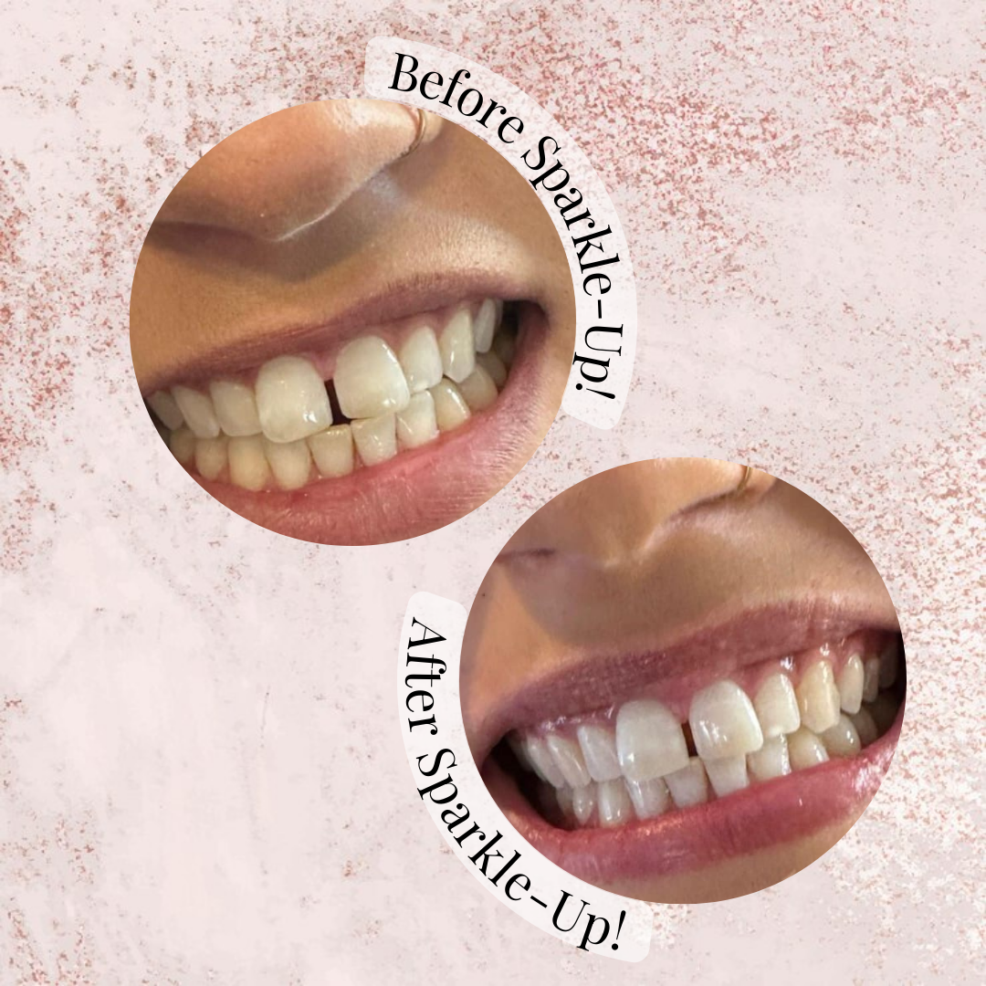 Copy of Copy of Copy of Copy of Copy of Copy of Copy of Copy of Copy of Copy of Copy of Copy of Sparkle-Up! March 2025 Conversion Posts (2)