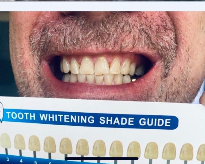 WhatsApp Image 2025-03-11 at 14.19.51